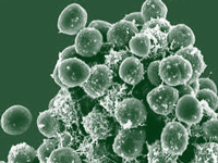 Antibiotic resistance making gonorrhoea treatment harder: World Health Organization