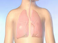 Lung cancer mortality rate among women may spike by 40%