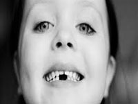 Chemical in plastic may weaken children's teeth irreversibly