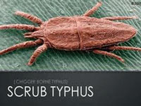 Scrub Typhus, the insect-borne disease